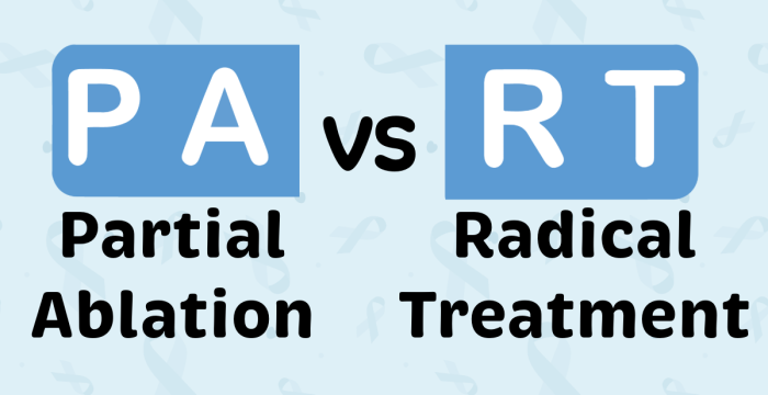 The PART Logo, displayed in two halves. The 'PA' has 'Partial Ablation' written underneath it and the 'RT' has 'Radical Treatment' written underneath it. Between the two halves are the letters 'v' and 's'.